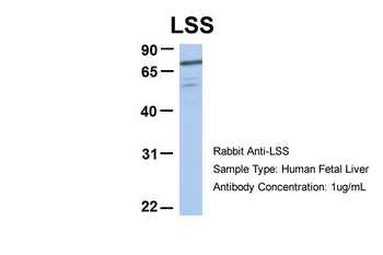 RIOK3 Rabbit Polyclonal Antibody