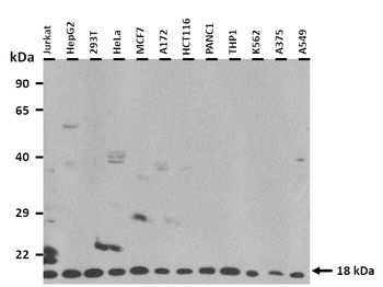 ACP1 Rabbit Polyclonal Antibody