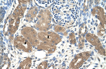 ACP1 Rabbit Polyclonal Antibody