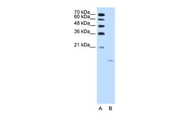ACP1 Rabbit Polyclonal Antibody