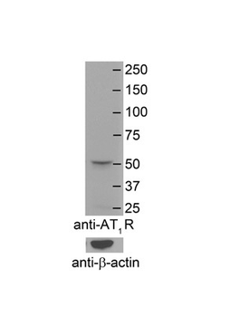 AGTR1 Rabbit Polyclonal Antibody
