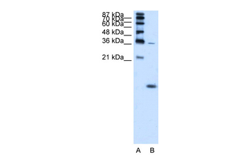 HBZ Rabbit Polyclonal Antibody