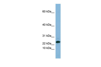 SPRR3 Rabbit Polyclonal Antibody