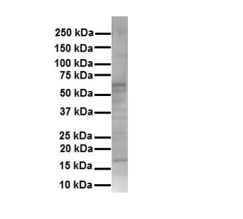 KRT16 Rabbit Polyclonal Antibody