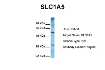 SLC1A5 Rabbit Polyclonal Antibody