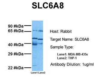 SLC6A8 Rabbit Polyclonal Antibody