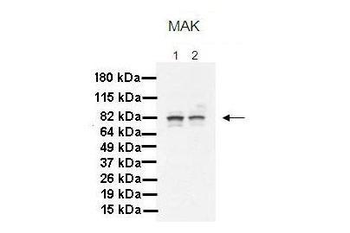 MAK Rabbit Polyclonal Antibody