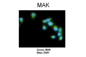 MAK Rabbit Polyclonal Antibody