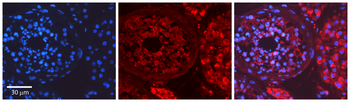 MYH1 Rabbit Polyclonal Antibody