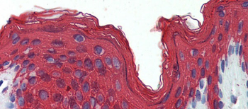 KRT1 Rabbit Polyclonal Antibody