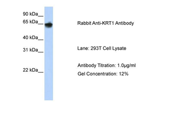 KRT1 Rabbit Polyclonal Antibody