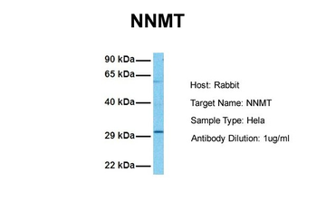 NNMT Rabbit Polyclonal Antibody