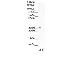 NNMT Rabbit Polyclonal Antibody