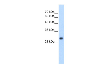 NNMT Rabbit Polyclonal Antibody