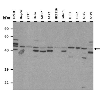 SLC17A3 Rabbit Polyclonal Antibody