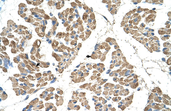 SLC22A7 Rabbit Polyclonal Antibody