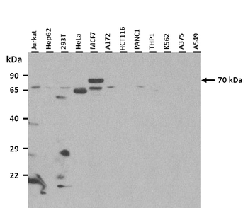 SLC20A2 Rabbit Polyclonal Antibody