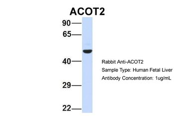 ACOT2 Rabbit Polyclonal Antibody