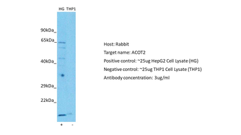 ACOT2 Rabbit Polyclonal Antibody