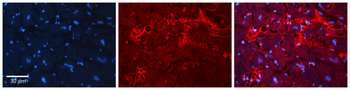 ACP1 Rabbit Polyclonal Antibody