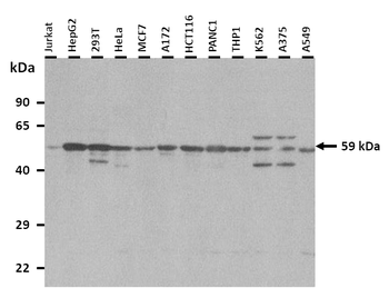 GPR161 Rabbit Polyclonal Antibody