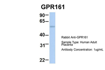 GPR161 Rabbit Polyclonal Antibody