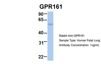 GPR161 Rabbit Polyclonal Antibody