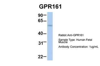 GPR161 Rabbit Polyclonal Antibody