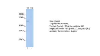 GPR161 Rabbit Polyclonal Antibody