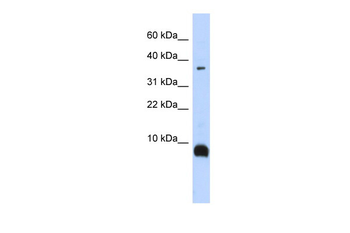 TAC3 Rabbit Polyclonal Antibody