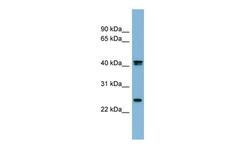 FETUB Rabbit Polyclonal Antibody
