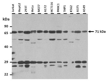 EIF2AK1 Rabbit Polyclonal Antibody
