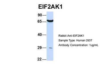EIF2AK1 Rabbit Polyclonal Antibody