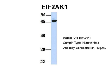 EIF2AK1 Rabbit Polyclonal Antibody