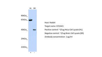 EIF2AK1 Rabbit Polyclonal Antibody