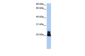 RHOD Rabbit Polyclonal Antibody