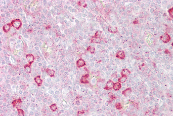 RHOD Rabbit Polyclonal Antibody