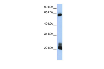 RHOD Rabbit Polyclonal Antibody