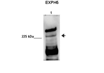 EXPH5 Rabbit Polyclonal Antibody