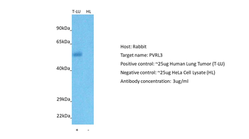 NECTIN3 Rabbit Polyclonal Antibody