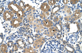 DCXR Rabbit Polyclonal Antibody