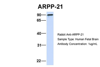 ARPP21 Rabbit Polyclonal Antibody