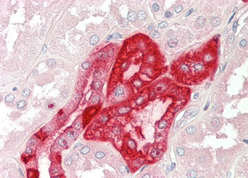 RHCG Rabbit Polyclonal Antibody