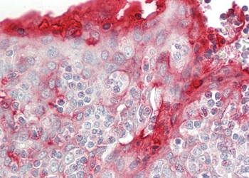RHCG Rabbit Polyclonal Antibody