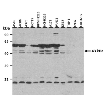 ASPN Rabbit Polyclonal Antibody