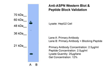 ASPN Rabbit Polyclonal Antibody
