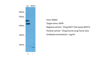 ASPN Rabbit Polyclonal Antibody