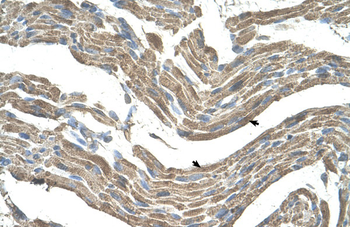 ASPN Rabbit Polyclonal Antibody