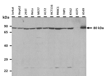 EPS8L1 Rabbit Polyclonal Antibody