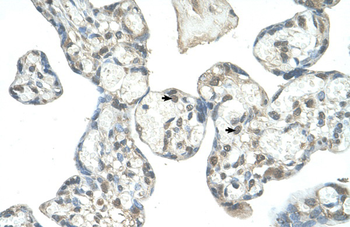 EPS8L1 Rabbit Polyclonal Antibody